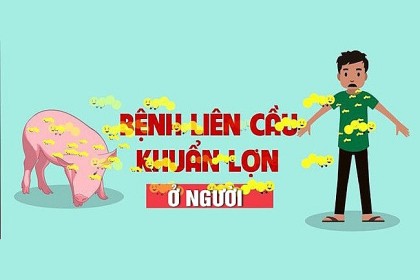 PHÒNG CHỐNG BỆNH LIÊN CẦU LỢN Ở NGƯỜI