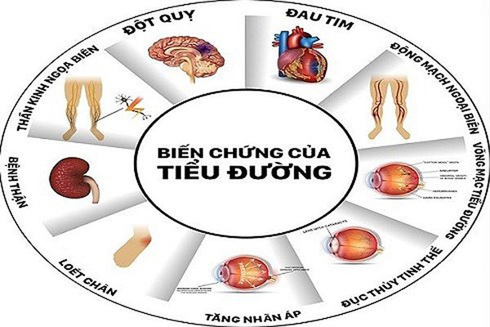 PHÒNG TRÁNH ĐÁI THÁO ĐƯỜNG